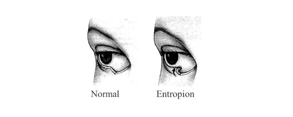 Entropion and eyelid problems