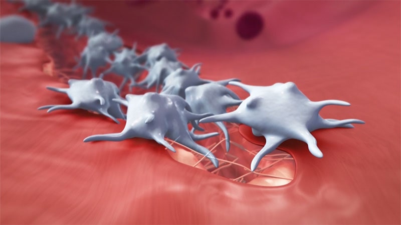 Diseases due to platelet disorders