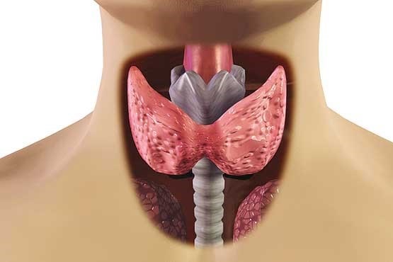 Different type of Thyroid disorders