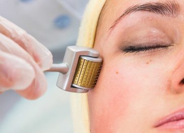What do you know about Microneedling method
