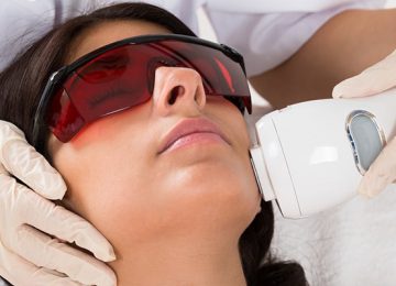 What is Laser hair removal?