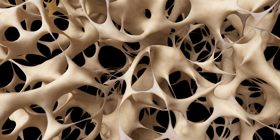 The most common causes of osteoporosis