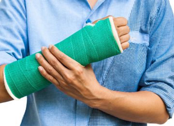 What is bone fracture?