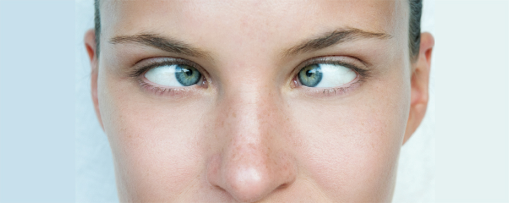 جراحی انحراف چشم یا لوچی (استرابیسم)